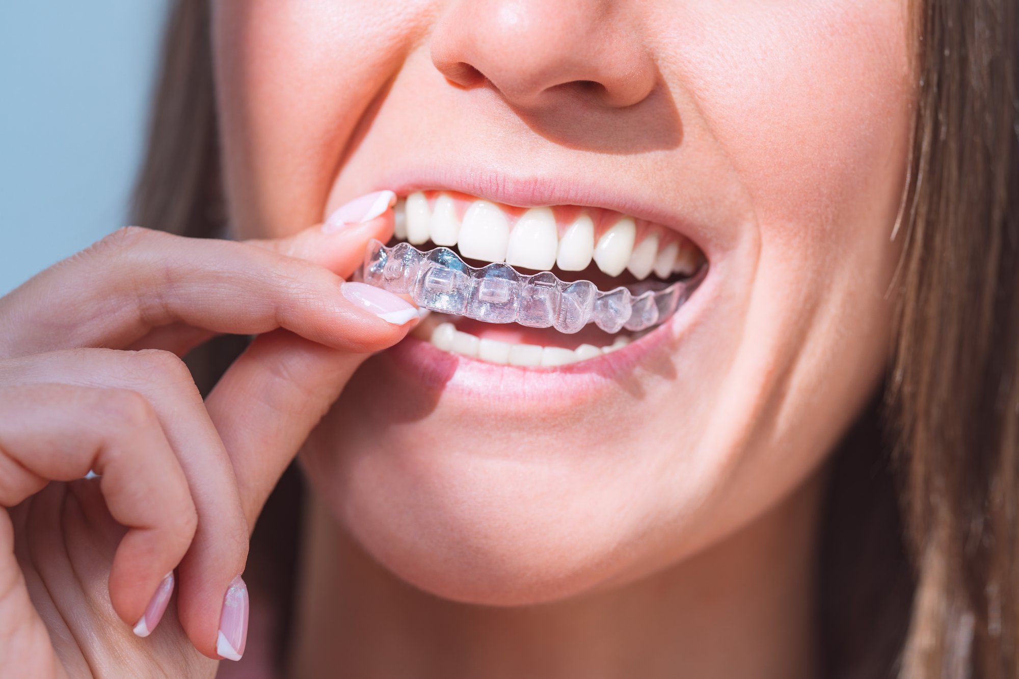 A cup of coffee beside a clear Invisalign aligner in its case